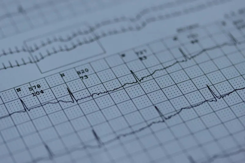 Wydruk zapisu EKG na papierze milimetrowym